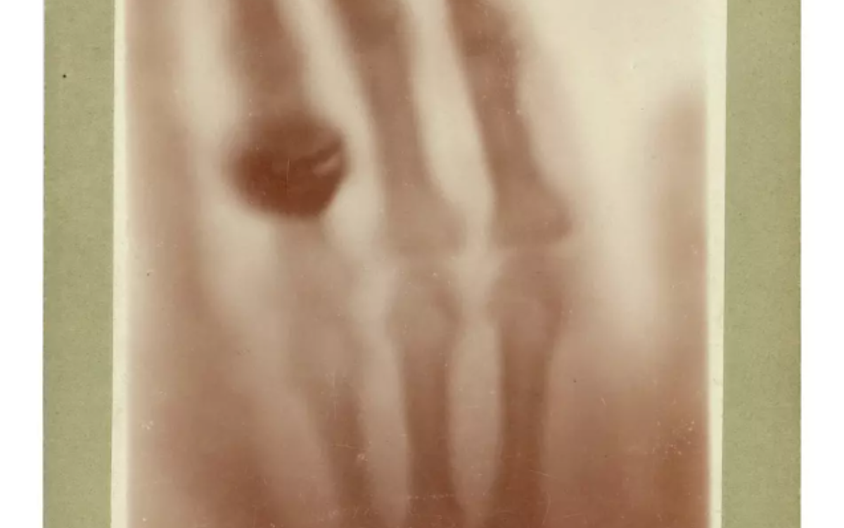 Die erste Roentgenaufnahme die Hand von Anna Bertha Roentgen Die erste Roentgenaufnahme die Hand von Anna Bertha Roentgen