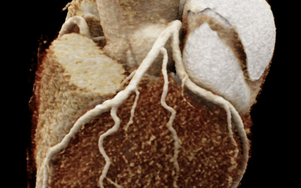 Ein Beispielbild des neuen CT Ein Beispielbild des neuen CT