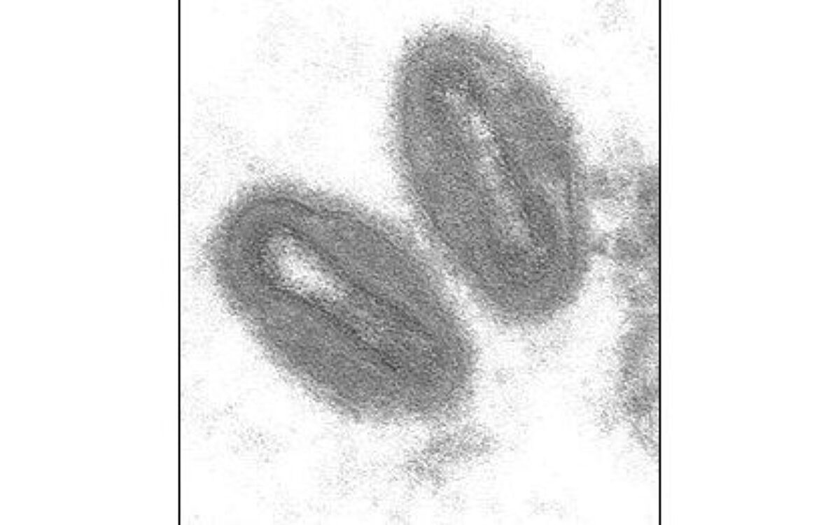 Affenpocken unter dem Mikroskop gesehen Affenpocken unter dem Mikroskop gesehen